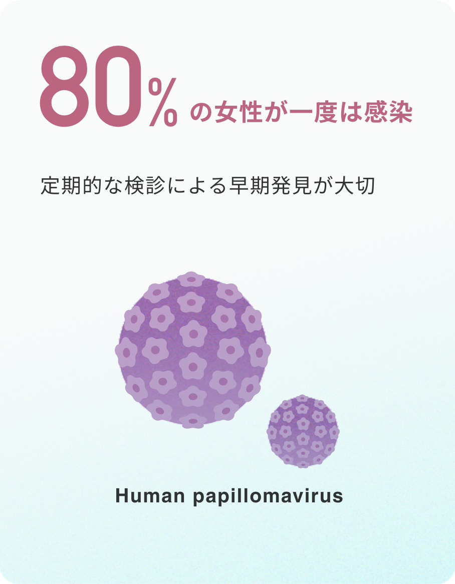 80%の女性が一度は感染 定期的な検診による早期発見が大切